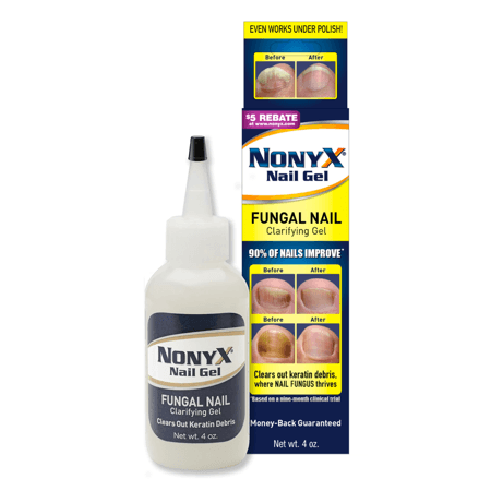 Picture of Nonyx Fungal Nail Clarifying Gel, 4oz